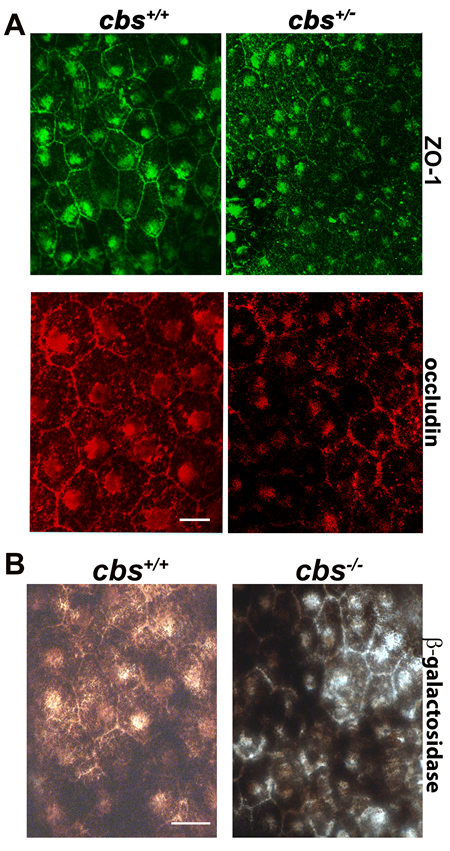 Evaluation of Outer Blood-Retinal Barrier.