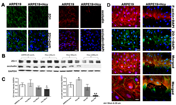 Evaluation of Tight junction proteins and cytoskeletal microfilament of ARPE-19 cells treated with and without Hcy-thiolactone.