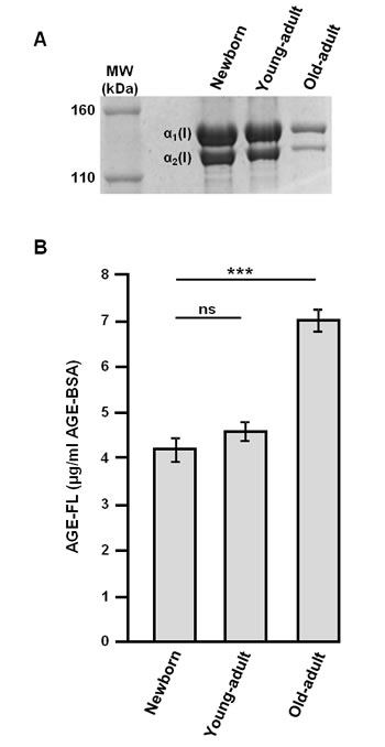 Biochemical characterization of different-age type I collagens.