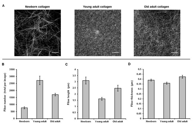 CRM analysis of 3D matrices as a function of collagen age.