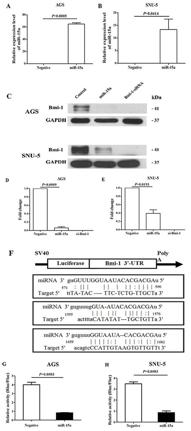 Regulation of Bmi-1 expression by miR-15a in gastric cancer cell lines.