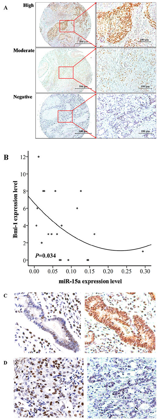 The expression level of miR-15a is inversely correlated with Bmi-1 expression in gastric tumor tissues.