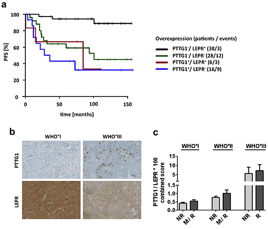 Survival association and protein expression of PTTG1 and LEPR.