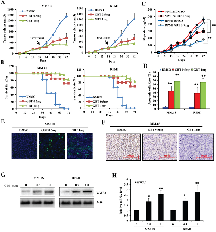 GBT suppresses MM xenograft tumors in mice model.