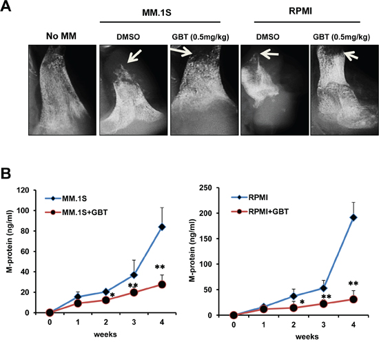 GBT alleviates bone destruction induced by MM cells in a SCID-hu mice model.