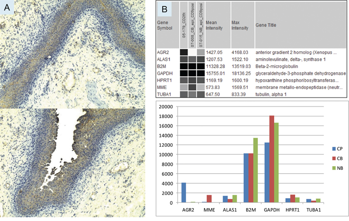 Bladder AGR2 expression.