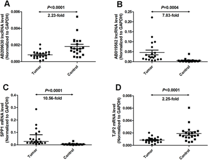 Quantitative determination of lncRNA/mRNA by means of qRT-PCR for AB209630 (A), AB019562 (B), SPP1 (C), and TJP2 (D) in tissues from hypopharyngeal carcinomas and adjacent noncancerous mucosae.