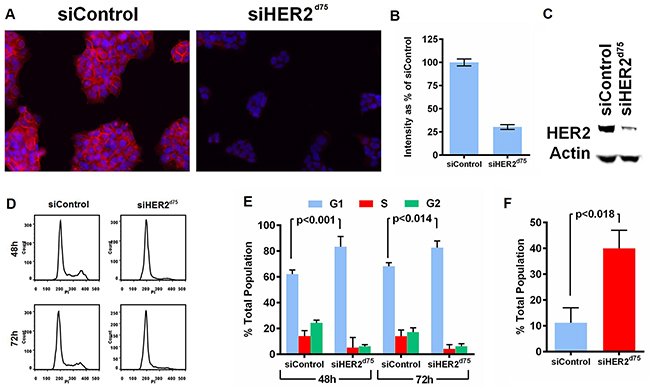 Effect of siHER2d75 on HER2 protein expression levels, cell cycle, and apoptosis in the BT474 cell line.