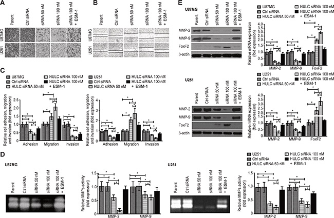 Effects of HULC on the invasion, adhesion and migration potential of glioma cells in vitro.