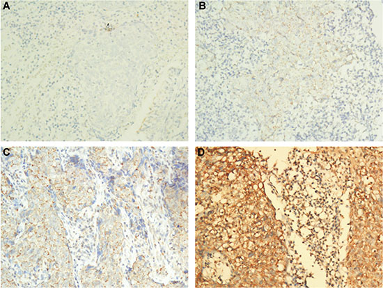 Representative images of the different intensities of the IHC staining for CTLA-4 expression.