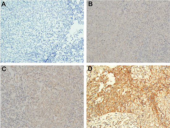 Representative images of the different intensities of IHC staining for CD28 expression.