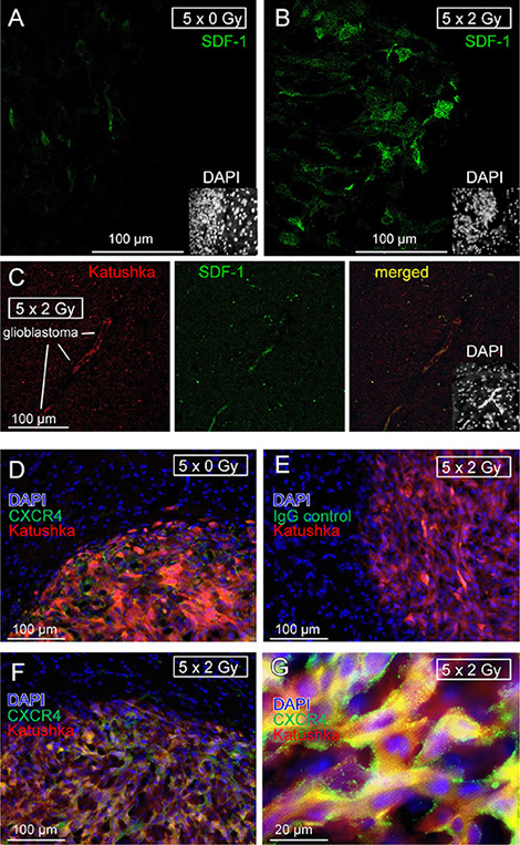 Fractionated IR stimulates in vivo SDF-1 protein expression by glioblastoma cells.