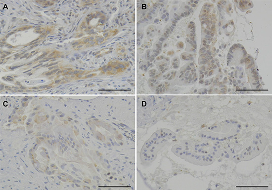 The immunohistochemical analysis for HSP27.