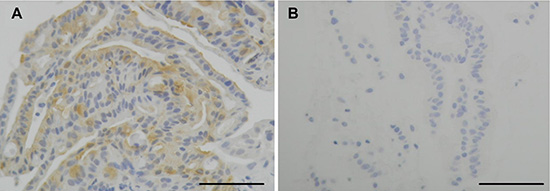 The immunohistochemical analysis for phosphorylated HSP27 (p-HSP27).