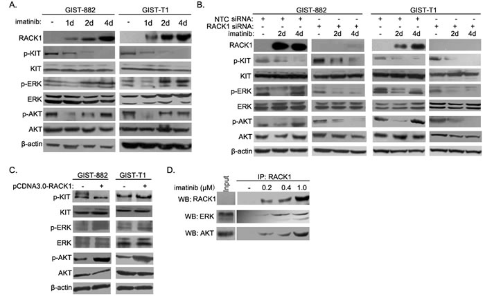 RACK1 reactivates the ERK and Akt pathways during induction of imatinib resistance in GIST cells.