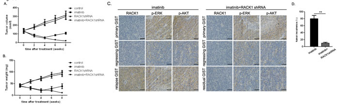 Combined imatinib and RACK1 shRNA treatment prevents GIST recurrence in xenografted mice.