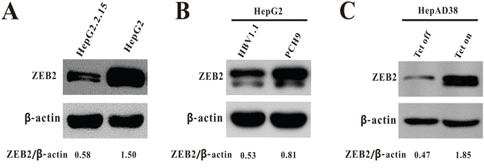 The expression of ZEB2 in HBV-expressing cells.