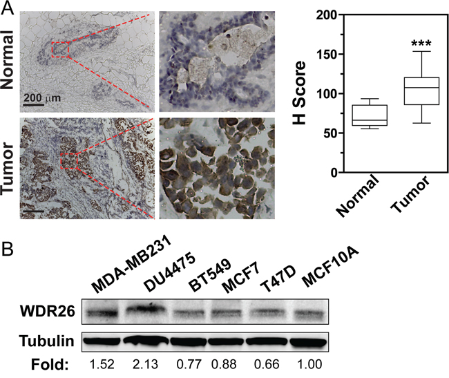 WDR26 is overexpressed in cell lines and tissue samples of human breast cancer.