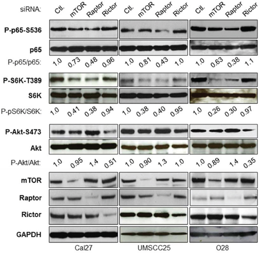 mTORC1, but not mTORC2 involves NF-&#x03BA;B activation in head and neck cancer cells.