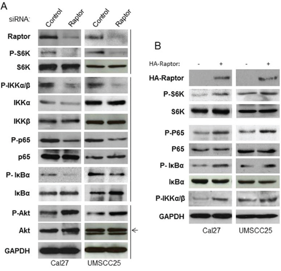 mTORC1 affects IKK activity downstream of Akt and upstream of NF-&#x03BA;B in HNSCC.