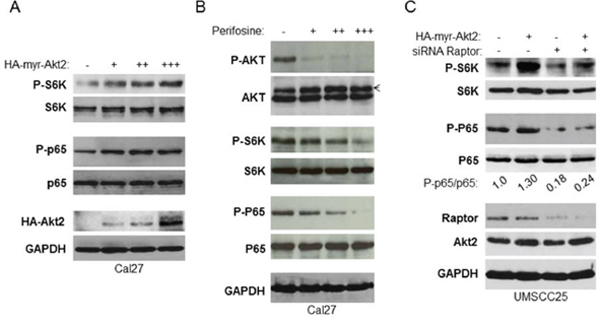 mTORC1 is required for Akt induction of NF-&#x03BA;B in HNSCC.