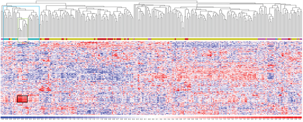 LncRNA expression profiling in plasma cell dyscrasia.