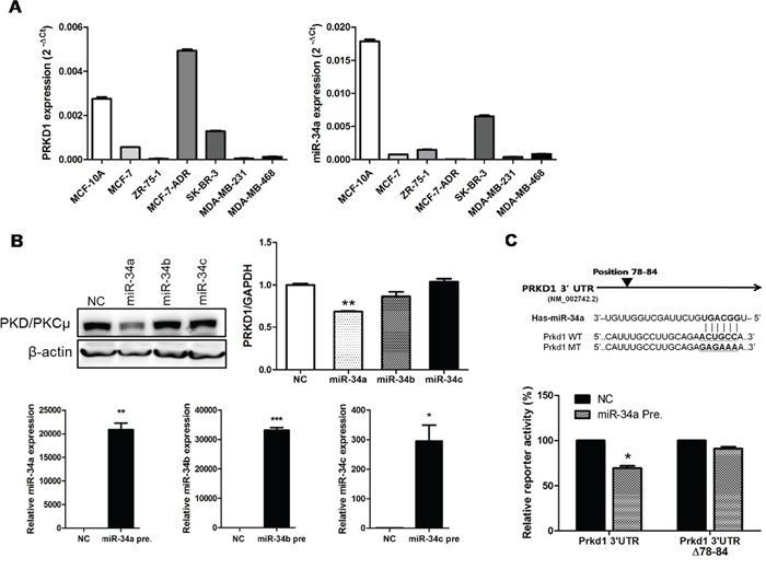 PRKD1 is a novel miR-34a target.