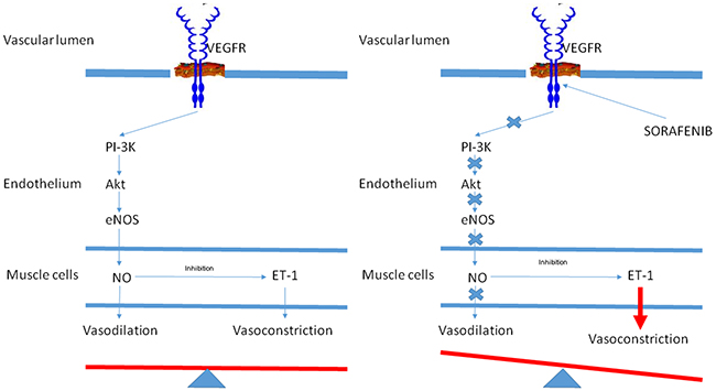 Hypothetic effect of vascular endothelial growth factor receptor (VEGFR) on blood vessel tone in patients A.
