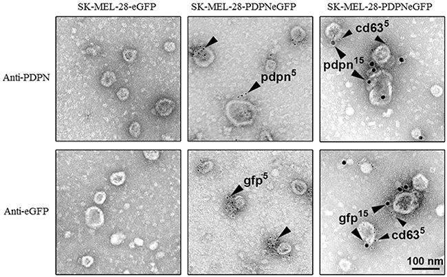 PDPN immunoelectron microscopy of EVs isolated from SK-MEL-28-PDPNeGFP cells.