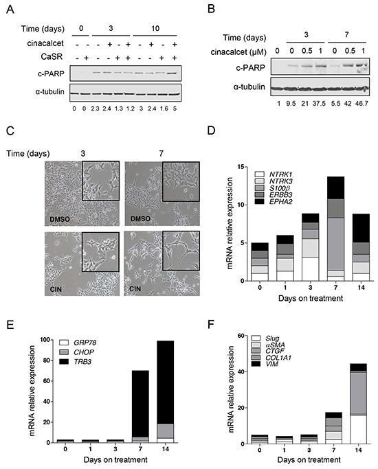 Prolonged in vitro exposure to cinacalcet induces apoptosis and cytodifferentiation in surviving neuroblastoma cells.