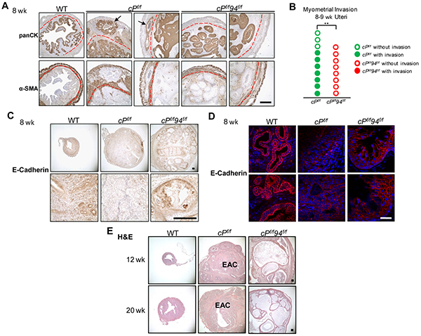Characterization of cPf/f94f/f uteri on myometrial invasion and prolonged stage.