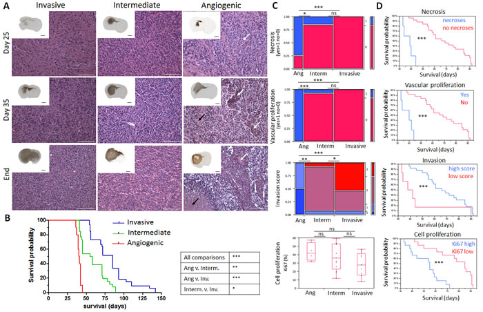 Time course of glioblastoma development and neuropathological analysis in patient-derived xenografts.