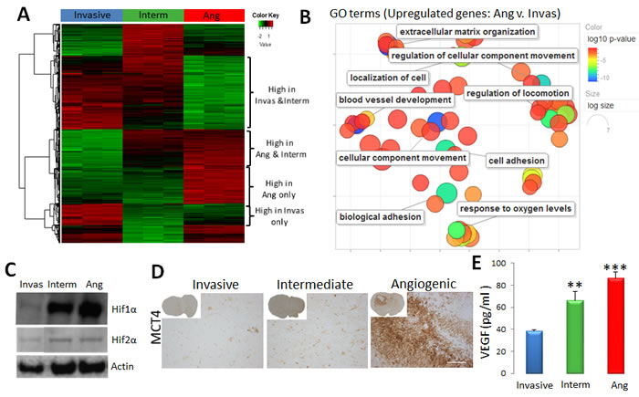 Tumour cell-specific gene expression profile of the three phenotypes.