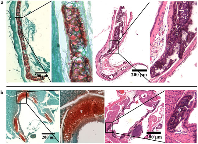 Extensive mineralization of elastic and hyaline cartilages in the