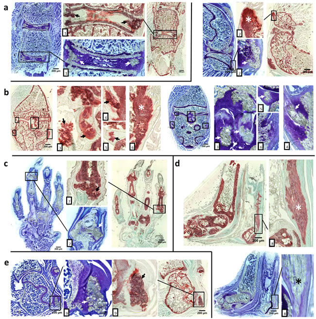 Aberrant cartilage and ligament mineralization in