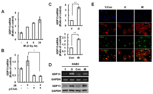 GDF15 expression levels in IR-induced endothelial cell senescence.