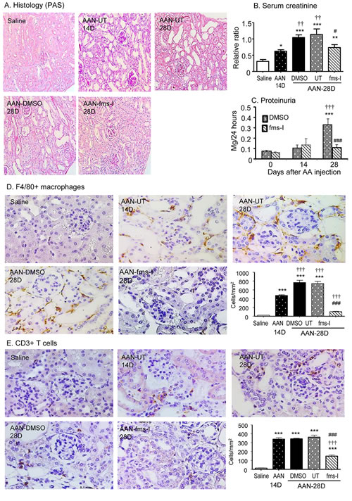 Treatment with fms-I (day 14 to 28) in the intervention study reverses macrophage accumulation and inhibits renal injury and inflammation in established AAN.