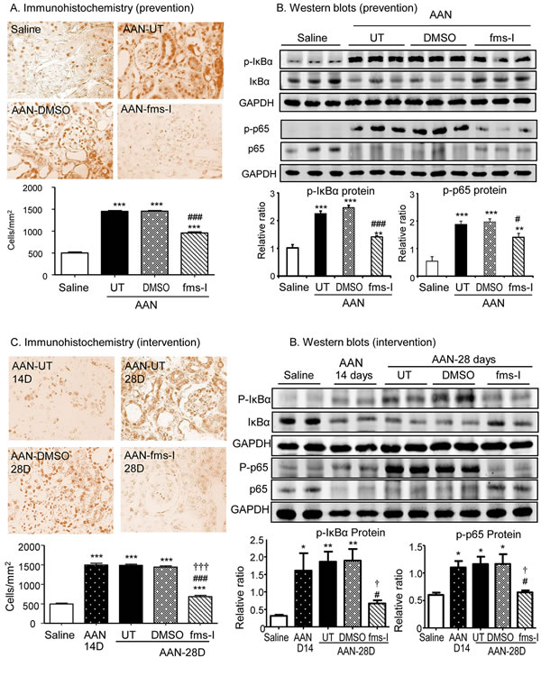 Treatment with fms-I inhibits activation of NF-kB signaling in chronic AAN.