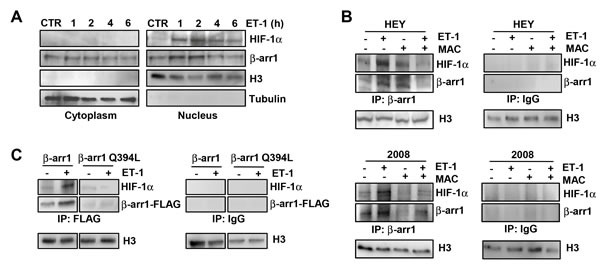 Nuclear &#x3b2;-arr1 interacts with HIF-1&#x3b1; in EOC cells upon ET