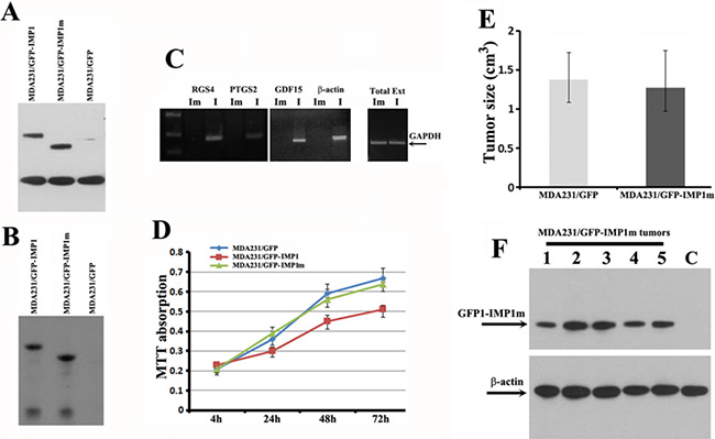 The KH34 domain of IMP1 is required for the target mRNA binding and for repressing proliferation of carcinoma cells as well as the growth of cell-derived breast tumors.