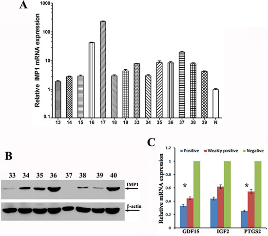 IMP1 expression correlated with the levels of its target mRNAs in human breast tumors.