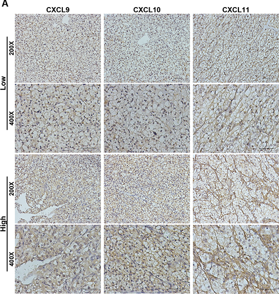 CXCL9, CXCL10 and CXCL11 immunohistochemical expression in non-metastatic ccRCC specimens.
