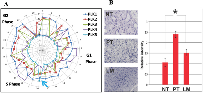 Plk5 mRNA perturbation during cell cycle and its protein expression support that Plk5 is a tumor suppressor.