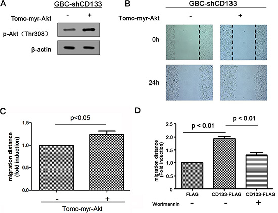 CD133 promotes gallbladder carcinoma cell migration through activating Akt phosphorylation.