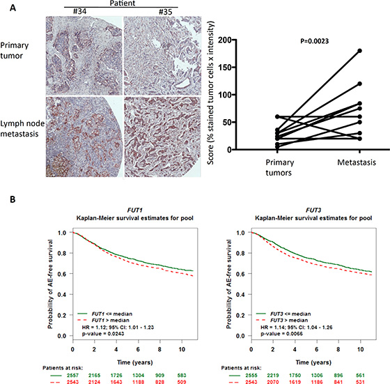 Associations between prolectin ligand expression, lymph node metastasis and clinical prognosis.