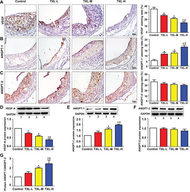 TXL regulates angiogenic factor expression in apoE-/- mice.