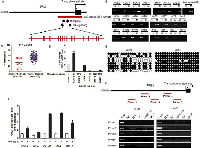 DNA and EZH2-mediated histone hypermethylation together contribute the silencing of FHL1 in HNSCC.