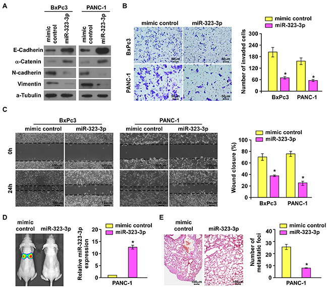 Overexpression of miR-323-3p suppressed invasion and metastasis of PDAC cells in vitro and in vivo.