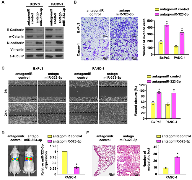 Silencing of miR-323-3p enhanced the invasive and metastatic abilities of PDAC cells in vitro and in vivo.