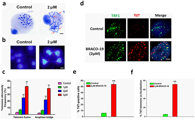 Telomere uncapping induced by BRACO-19.